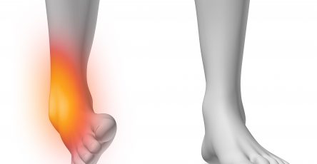 Cara Mengobati Cedera Sprain Engkel / Angkle (Ankle) & Mata Kaki Bengkak