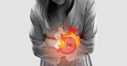 Penyebab Asam Lambung Naik Cara Menurunkan Asam Lambung / Maag & Mengatasi Gejala GERD