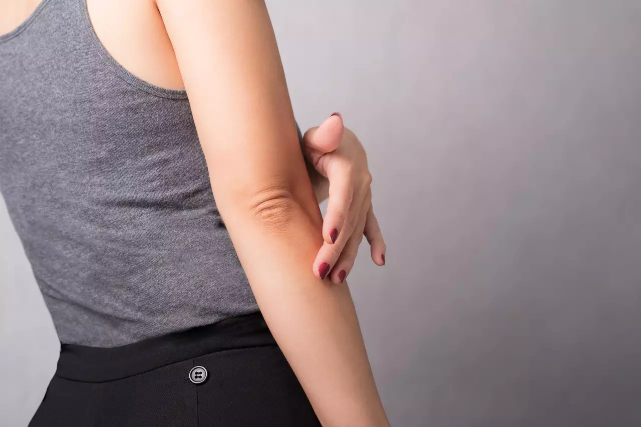 cara menghilangkan siku hitam dengan cepat
